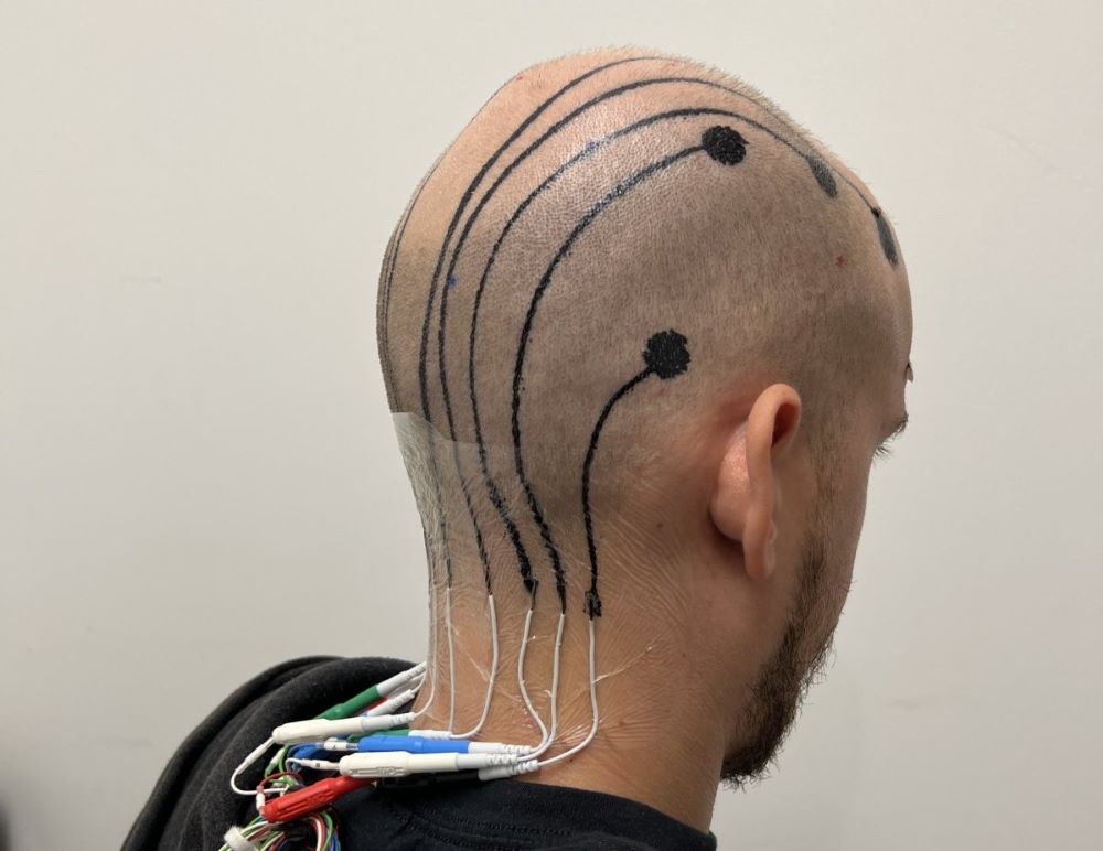 brain activity measuring with scalp tattoo