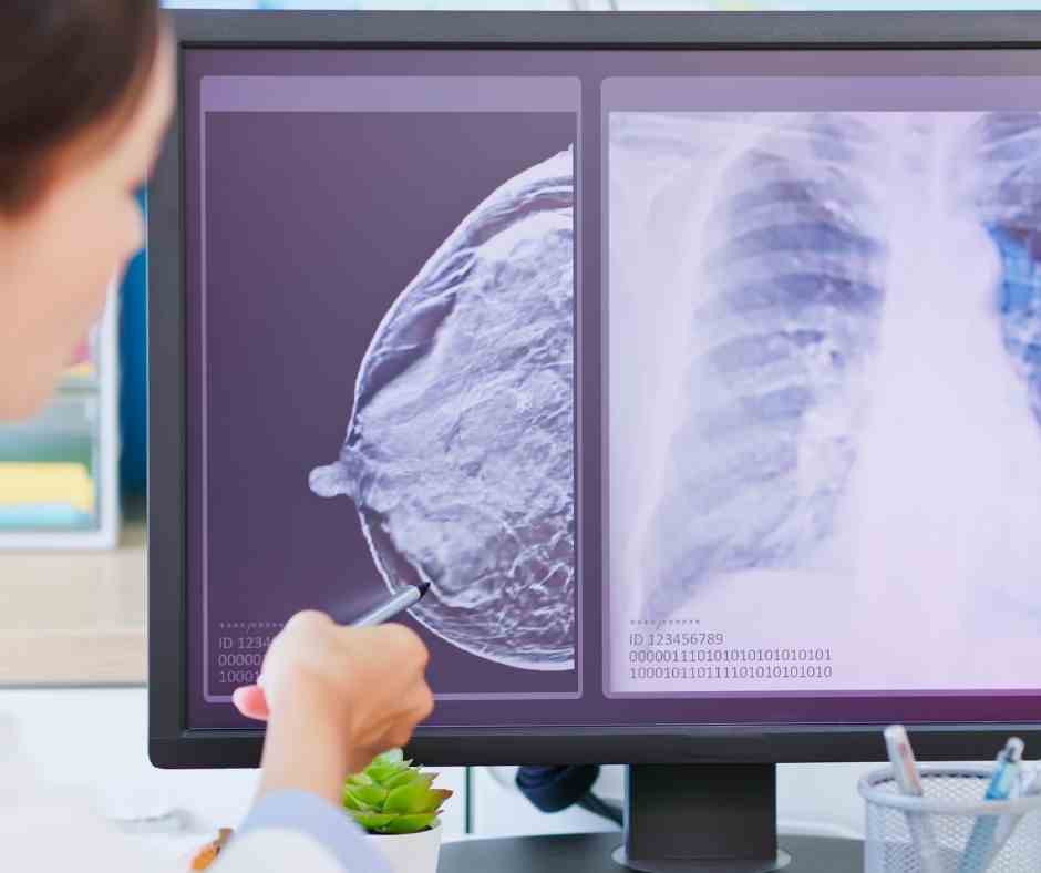 Cancer detection
